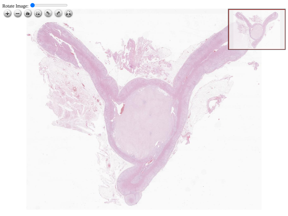 Fotomicrografia histológica, HE, catalogada em Histopathology Atlas / patolojiAI sob o título “ganglioneuroma in adrenal gland”. Conteúdo não revisado pelo Domine Aqui.