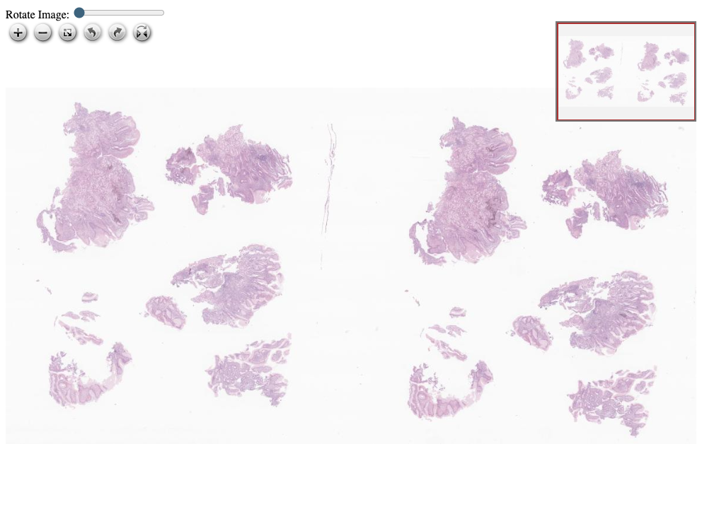 Fotomicrografia histológica, HE, catalogada em Histopathology Atlas / patolojiAI sob o título “Sarcina ventriculi”. Conteúdo não revisado pelo Domine Aqui.